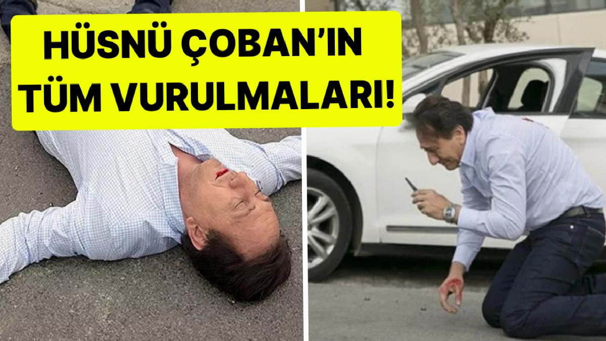 Hüsnü Çoban Arka Sokaklarda Kaç Kez Vuruldu? Sayı İle Şaşırtan Detaylar!