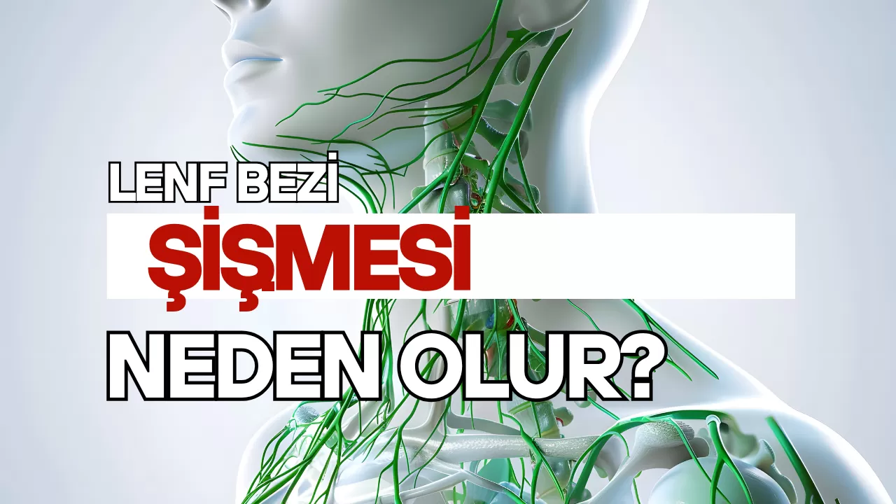 LENF BEZİ ŞİŞMESİ