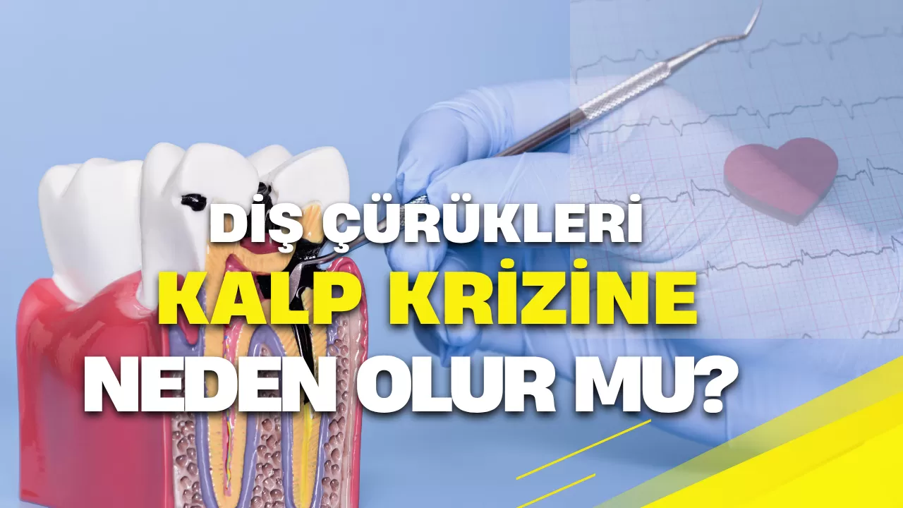 Diş Çürükleri Kalp Krizine Neden Olur mu?