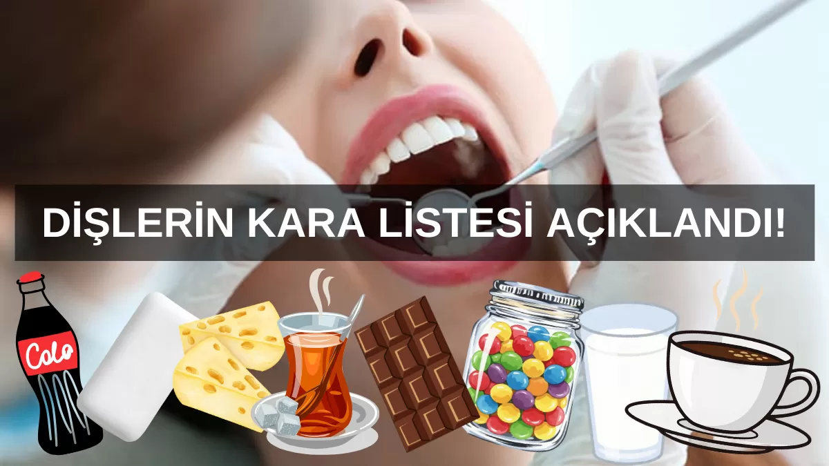 Dişlerin Kara Listesi Açıklandı: Uzman Diş Hekiminden Besinlere 10 Üzerinden “Zarar” Puanı!