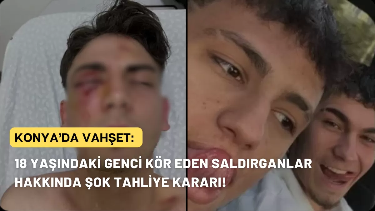 Konya’da Vahşet: 18 Yaşındaki Genci Kör Eden Saldırganlar Hakkında Şok Tahliye Kararı!