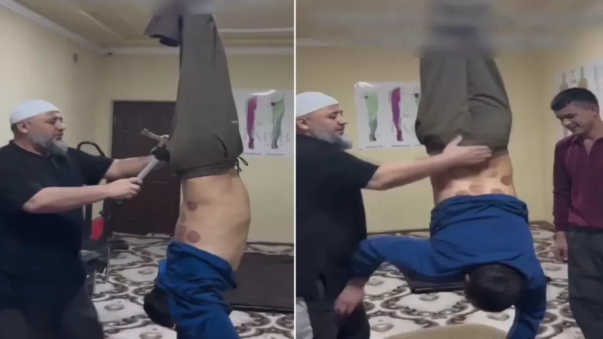 ŞİFA DEĞİL VAHŞET! Bel Fıtığı Hastasını Ayaklarından Tavana Asıp Çekiçle Dövdü: Görüntüler İnfial Yarattı!