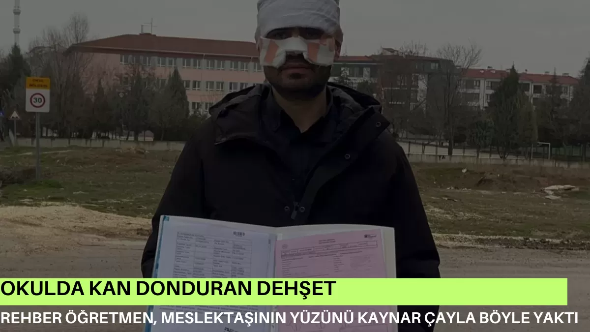OKULDA KAN DONDURAN DEHŞET! Rehber Öğretmen, Meslektaşının Yüzünü Kaynar Çayla Böyle Yaktı